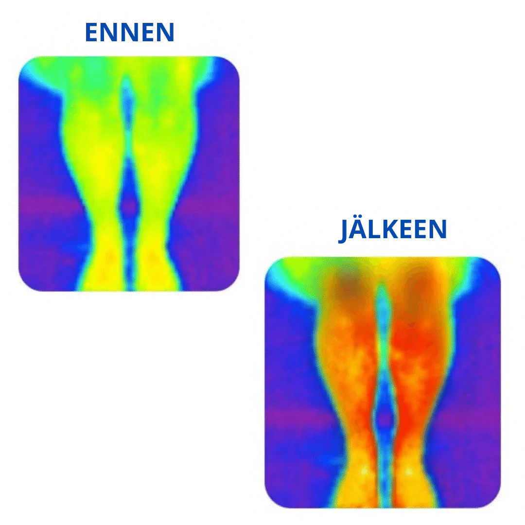 Kompressiolahkeet - Image 5